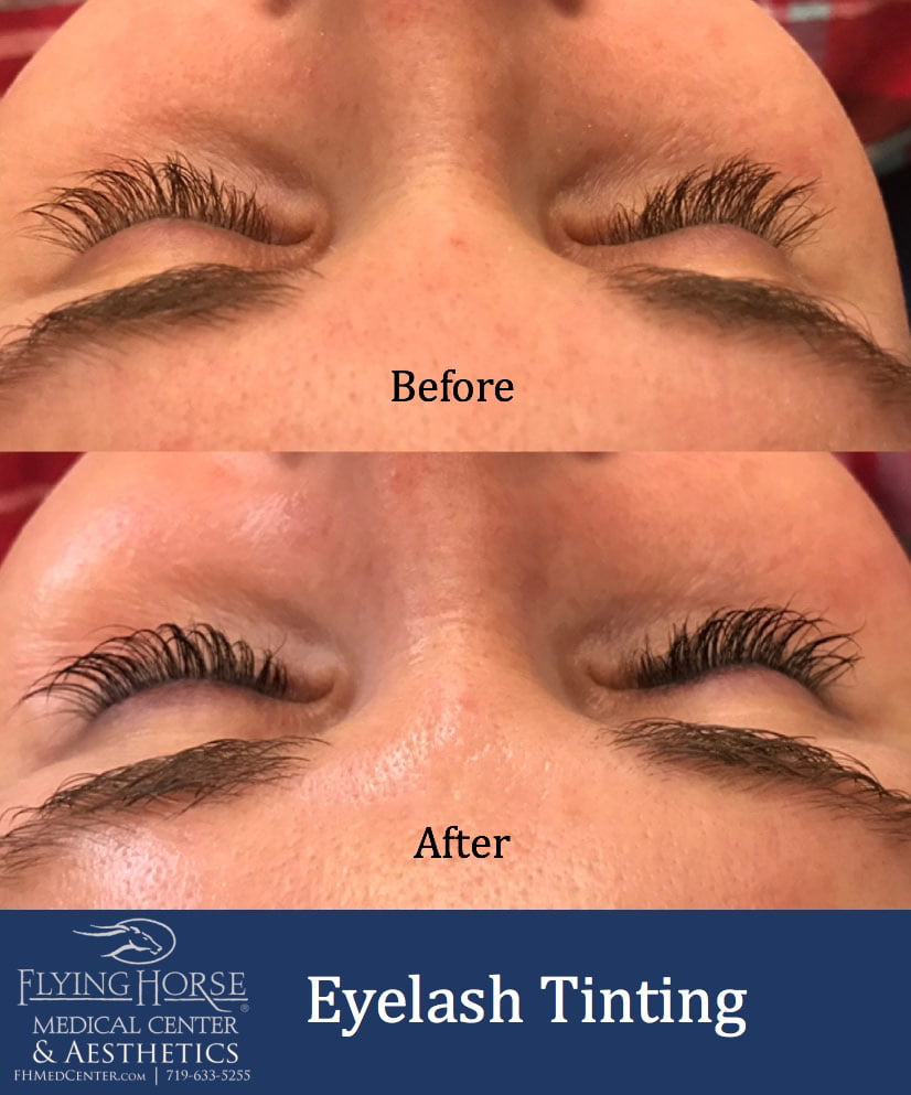 Additional Aesthetic Services-Eyelash tinting Services-Flying Horse Medical Center