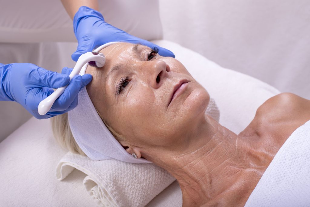 Microneedling Services - Aesthetic Services at Flying Horse Medical Center