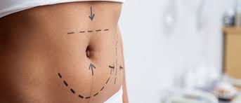 Plastic Surgery at Flying Horse Medical Center