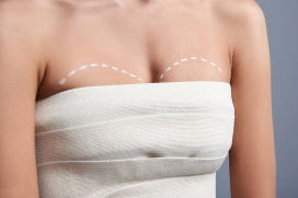 Breast Implant Exchange with Breast Lift-Plastic Surgery Flying Horse Medical Center