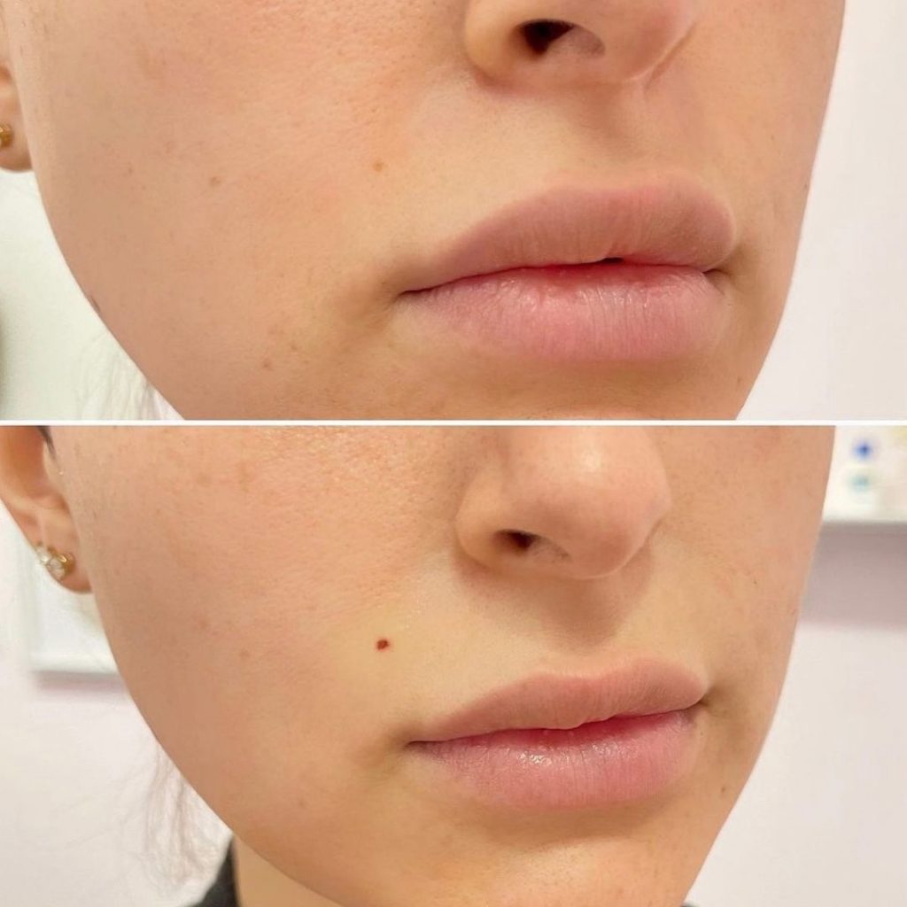 Flying Horse Medical Center | Colorado Springs & Monument | Concierge Medicine, Plastic Surgery, Aesthetics