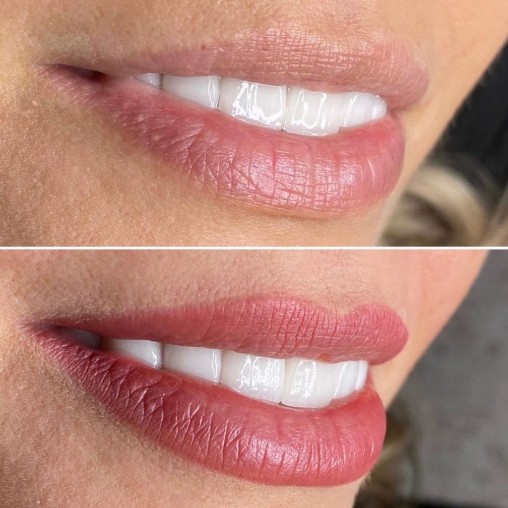 Flying Horse Medical Center | Colorado Springs & Monument | Concierge Medicine, Plastic Surgery, Aesthetics