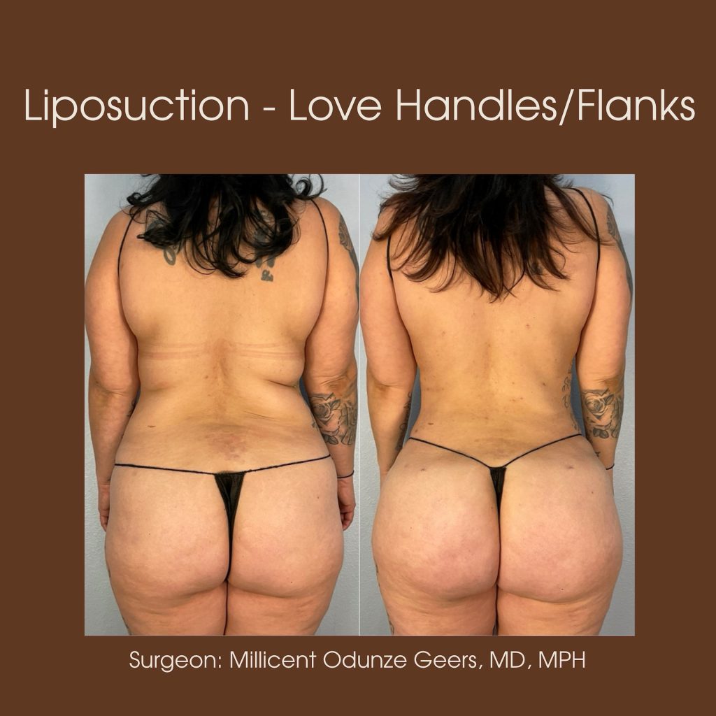 Flying Horse Medical Center | Colorado Springs & Monument | Concierge Medicine, Plastic Surgery, Aesthetics, Psychiatry